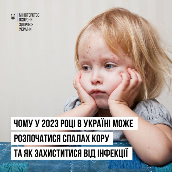 
В Україні фіксують спалахи кору: як захистити від недуги дітей