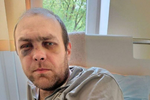 За майже місяць так і не знайшли чоловіків у формі, які побили тернополянина в супермаркеті