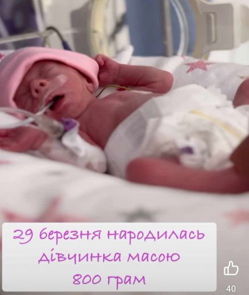 
У Тернополі виходили «дюймовочку», яка народилася з вагою 800 грам (відео)