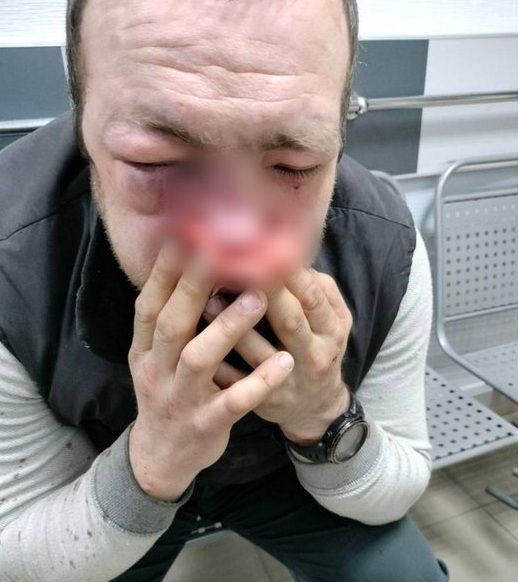 За майже місяць так і не знайшли чоловіків у формі, які побили тернополянина в супермаркеті