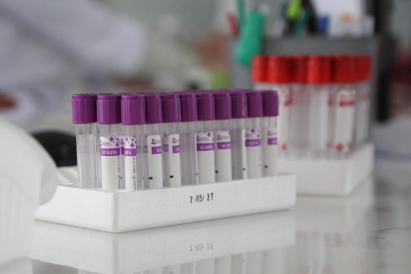 У Тернополі десятки людей здали кров в пам'ять про медика та воїна Івана Попіля (фото)