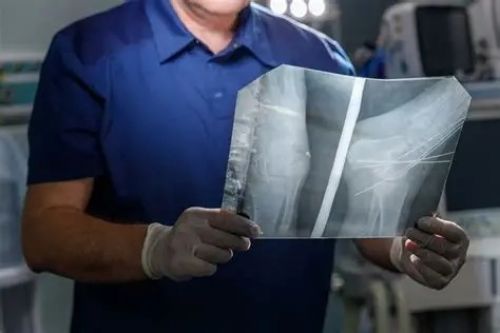 Хлопчик знову може бігати: тернопільські медики провели складну операцію на стопі (відео)