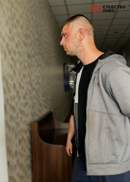 У Львові напали на військовослужбовців ТЦК та СП і розбили службове авто: підозрюваного взяли під варту, частина учасників вибачилася (фото, відео)