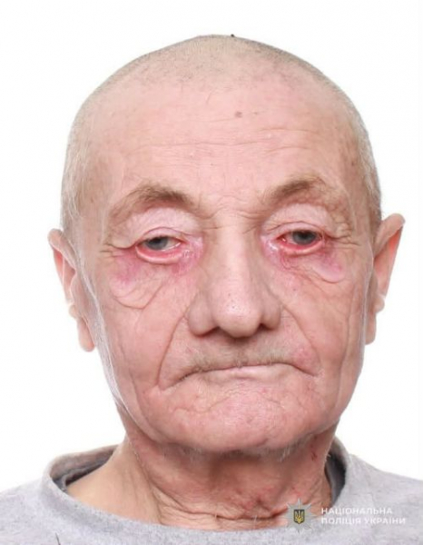 Пішов з дому і не повернувся: поліція розшукує жителя Зборівщини, який майже нічого не бачить